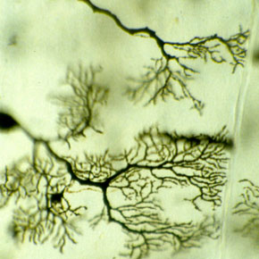nerve cells 3D Stereo Pair Edge-3D microscope
